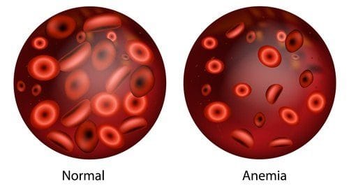 MMA Anemia Problems