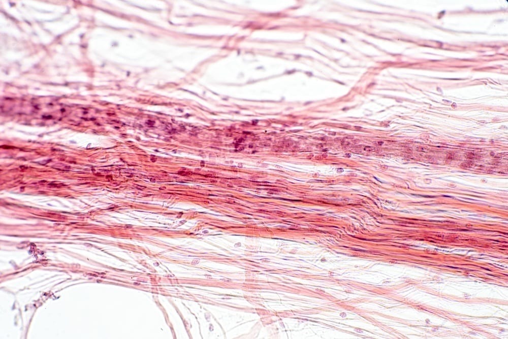 Body Physiology Areolar Connective Tissue | Fighting Arts Health Lab