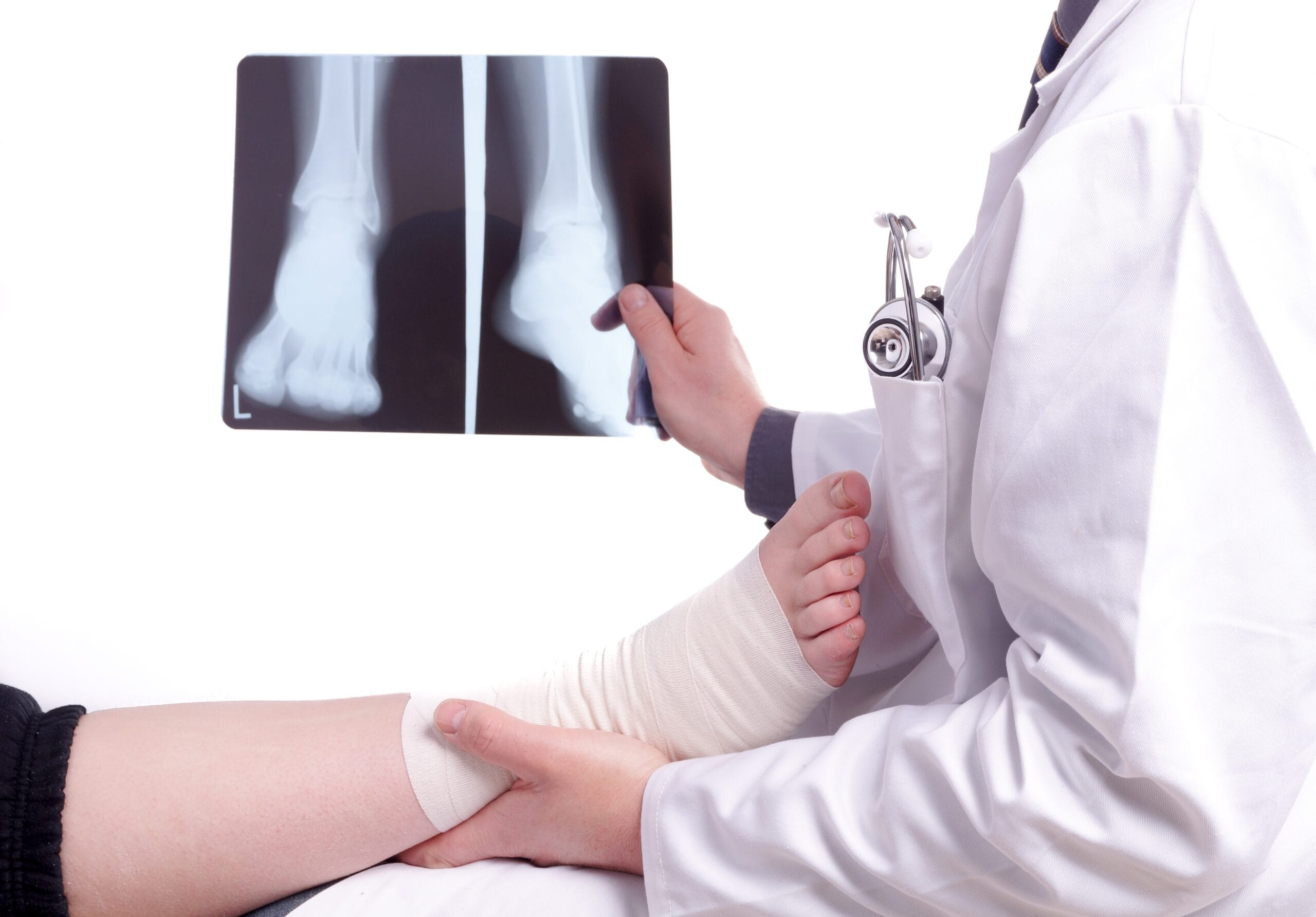 Combat Arts Ankle Injuries Diagnosis | Fighting Arts Health Lab