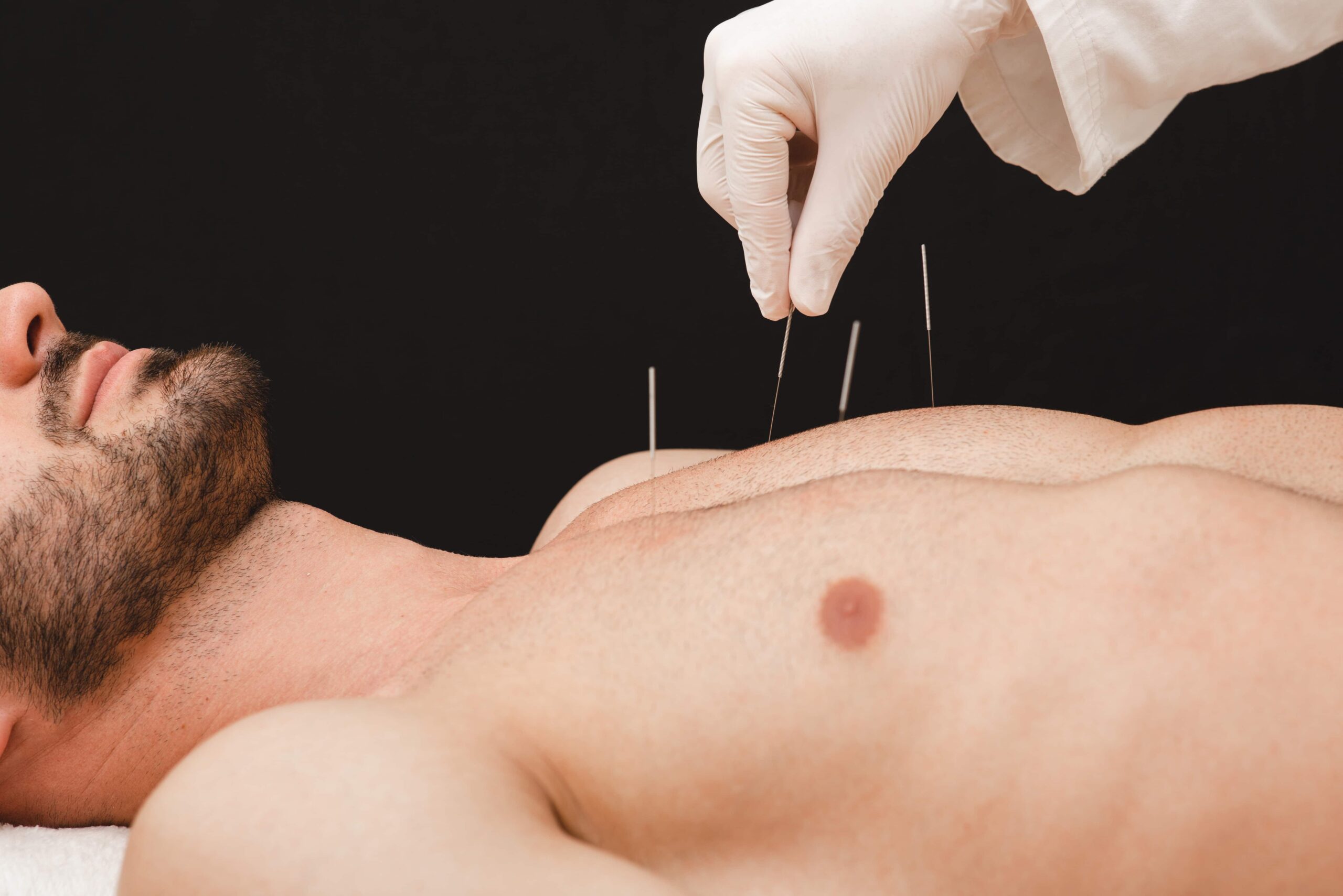 Chest Treatment Acupuncture | Fighting Arts Health Lab