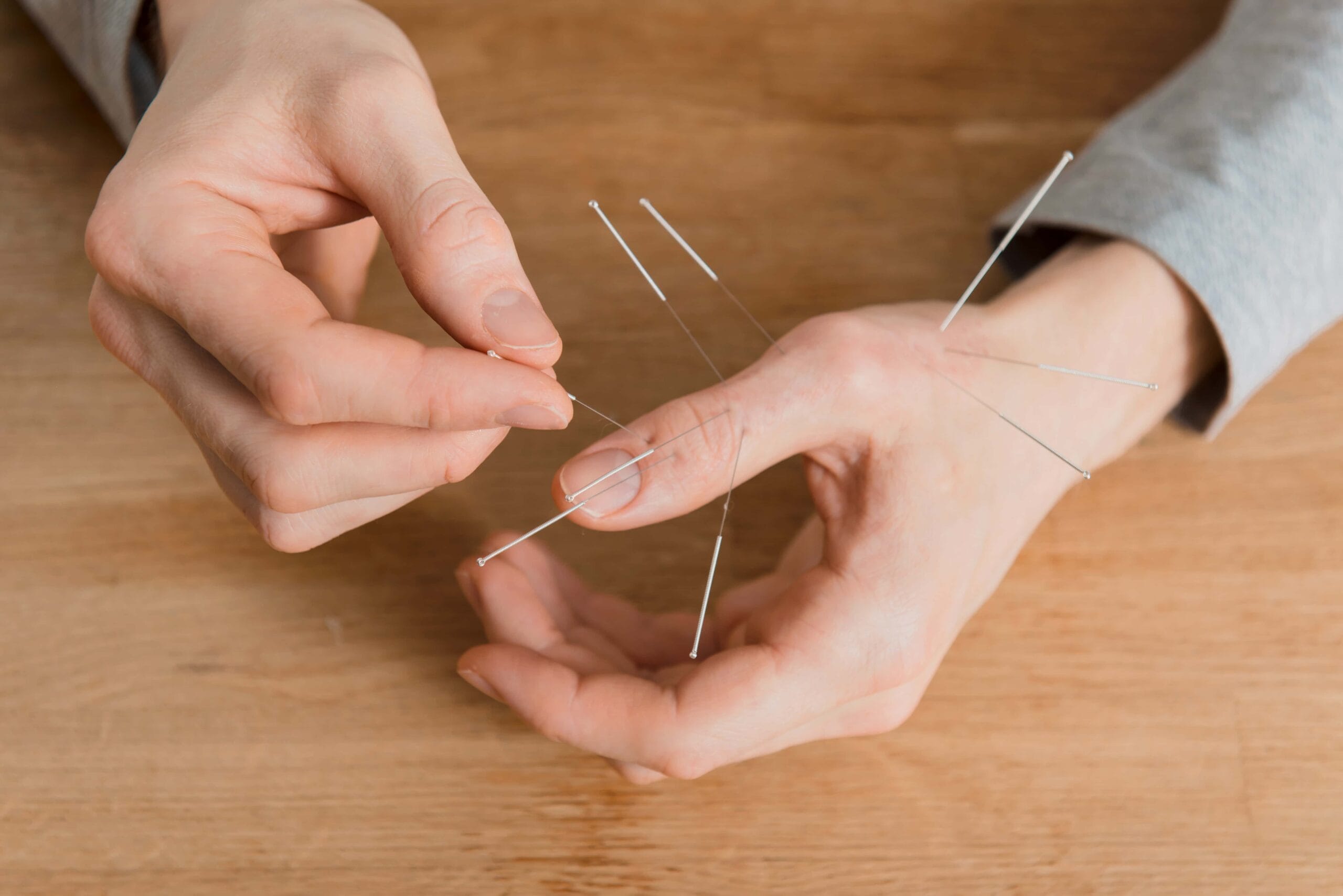 Combat Arts Finger Injuries Treatment Acupuncture | Fighting Arts Health lab