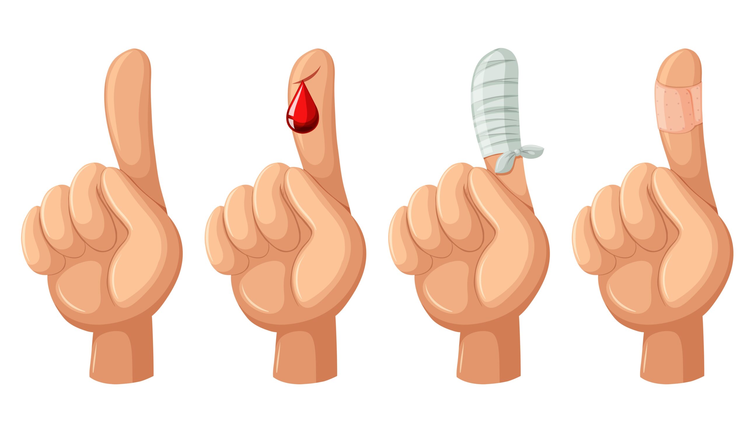 Combat Arts Finger Injuries Symptoms