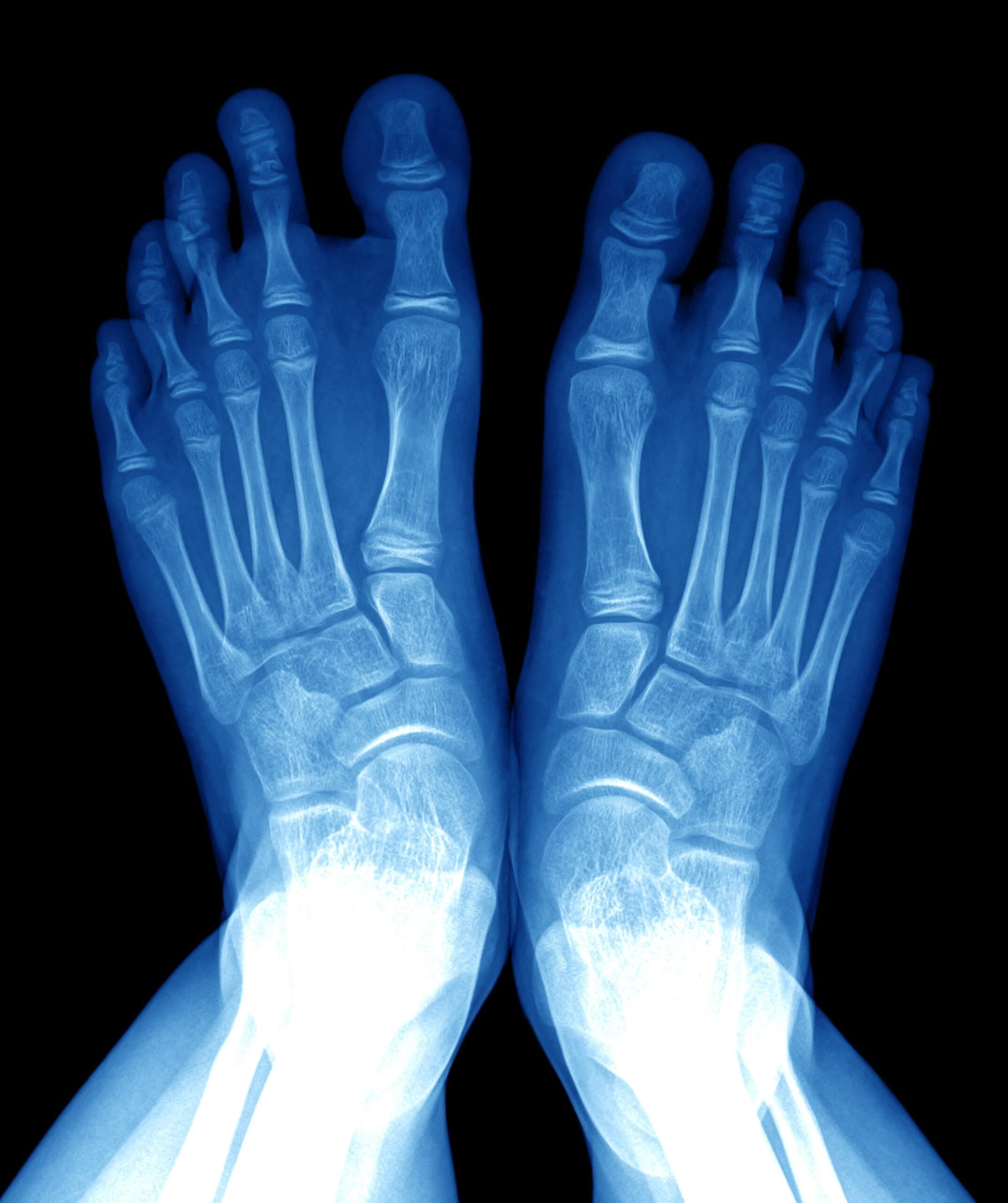 Foot Injury Diagnosis | Fighting Arts Health Lab