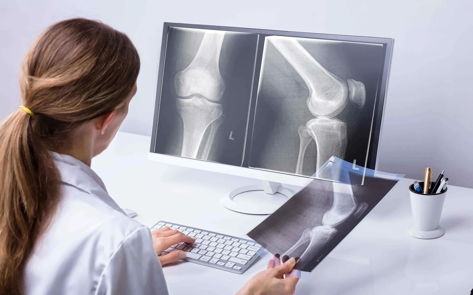 Knee Injury Diagnosis Knee Injury Diagnosis