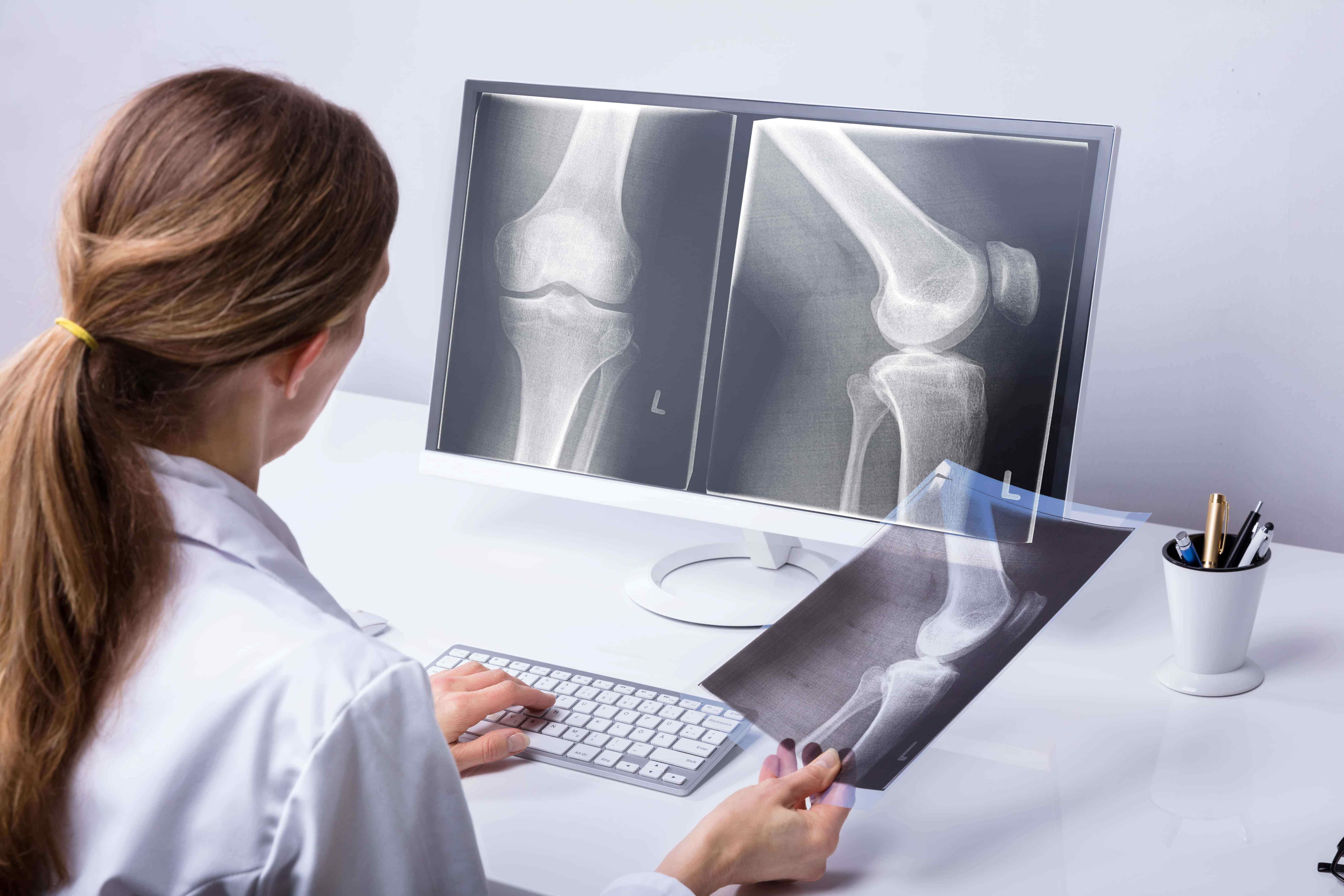 Knee Injury Diagnosis | Fighting Arts Health Lab