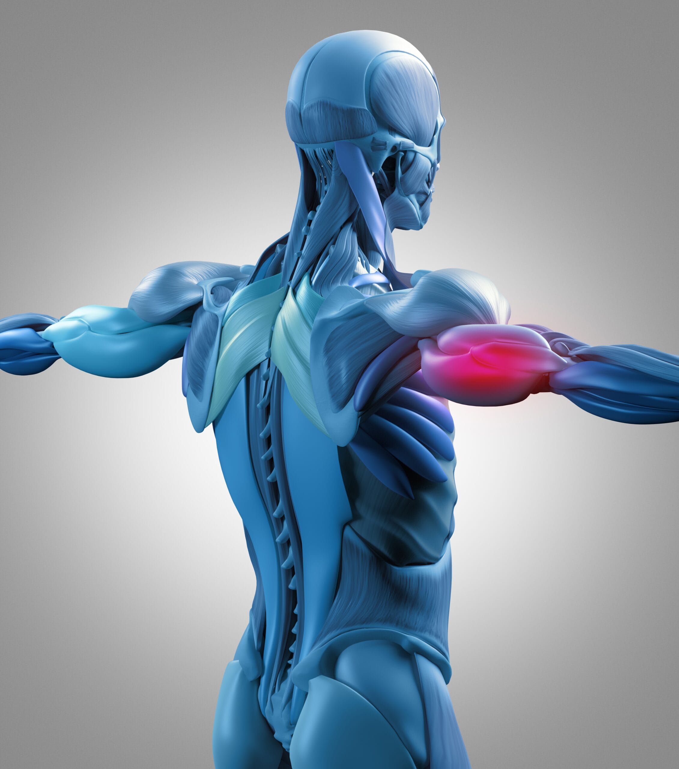 Tricep Model Pain Illustration | Fighting Arts Health Lab