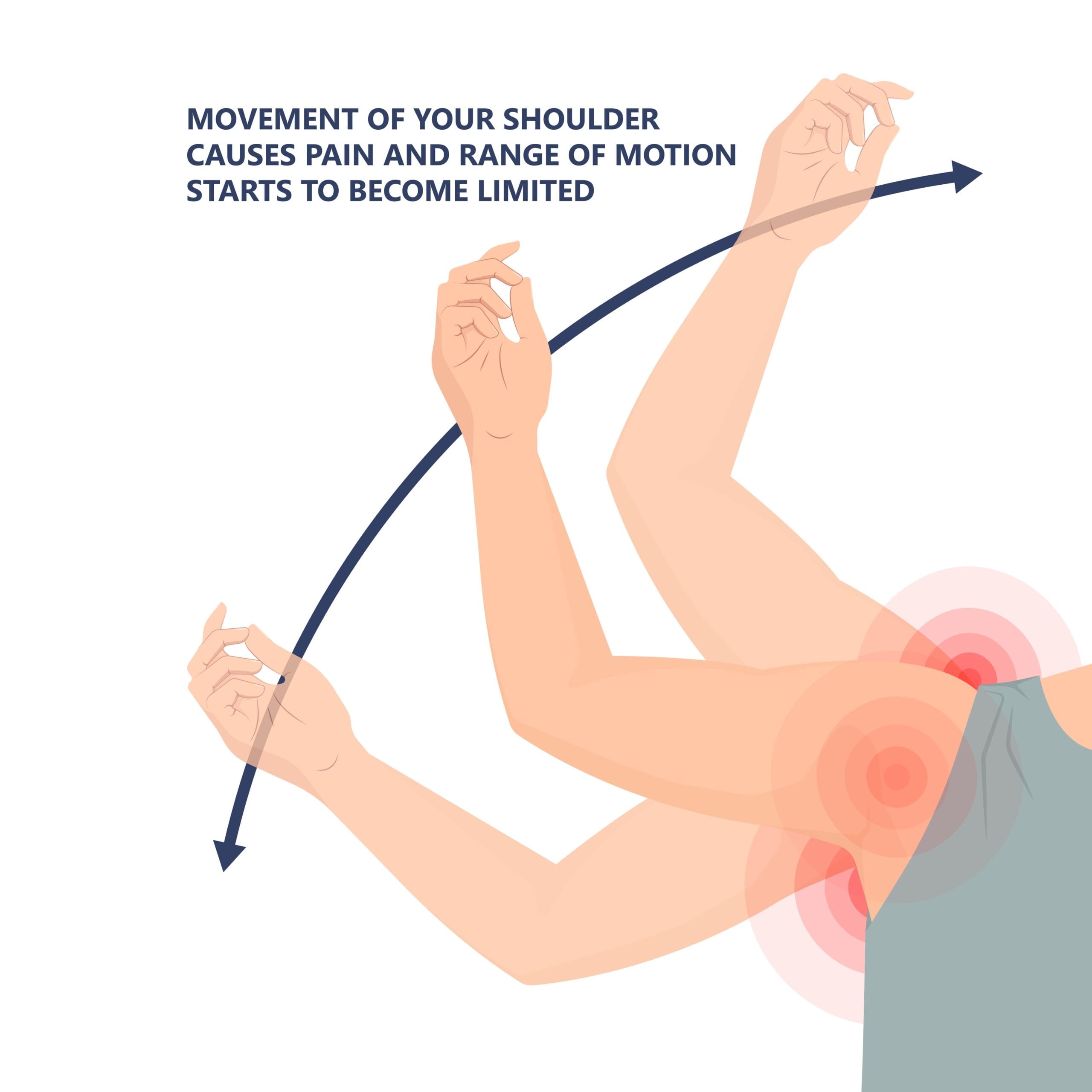 Rotator Cuff Range of Motion | Fighting Arts Health Lab